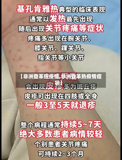 【非洲登革热疫情,非洲登革热疫情症状】-第2张图片
